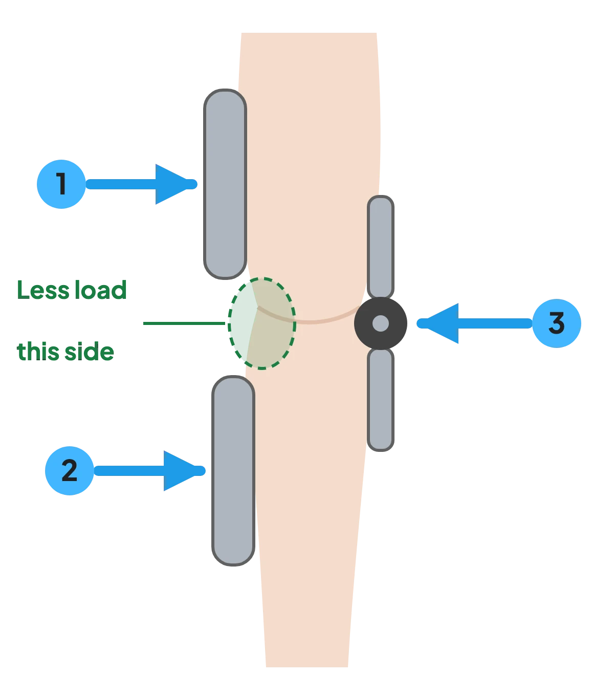 Diagram: an unloader brace presses at the thigh and calf on one side and at the hinge on the other side, taking load off one side of the knee